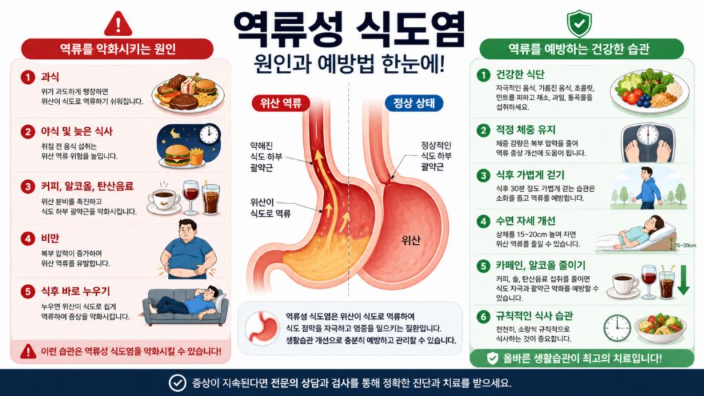 역류성 식도염의 주요 원인과 생활습관 개선 방법을 비교한 인포그래픽